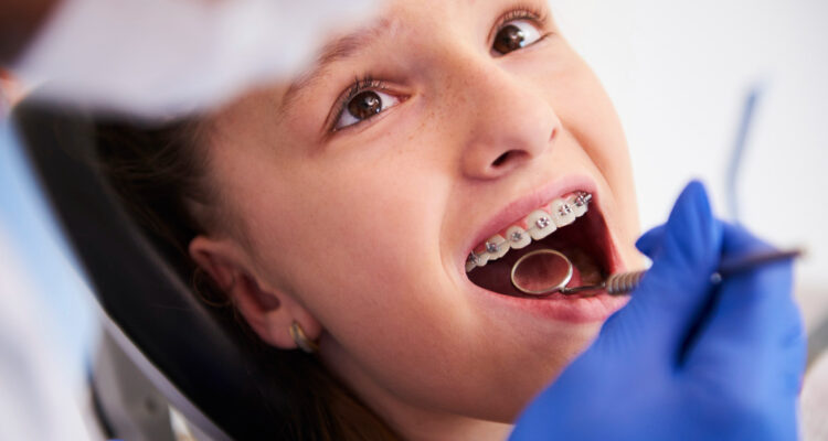 Diş Teli Tedavisi Aşamaları