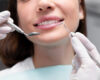 Diş Estetiği Tedavisi