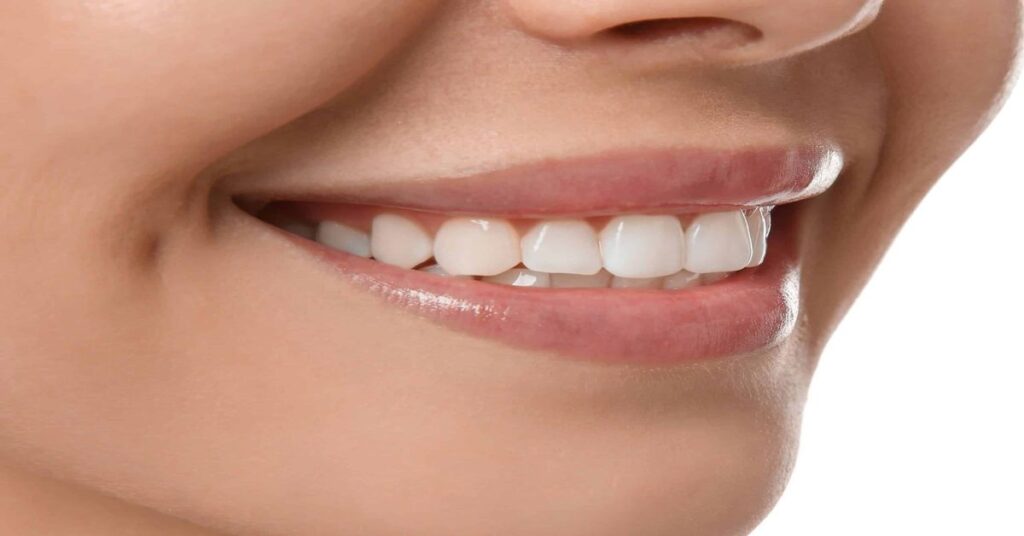 Diş Estetiği Nasıl Yapılır? Diş Estetiği Nasıl Yapılır?